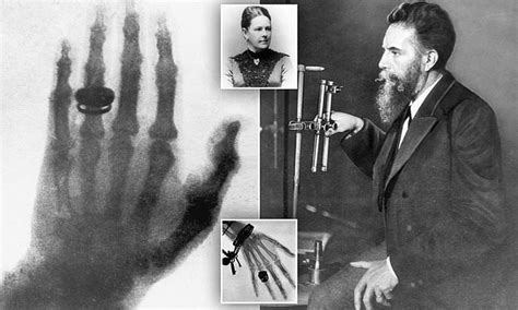 Roentgen S First Human X Ray Of His Wife S Hand In 1895 Daily Mail Online