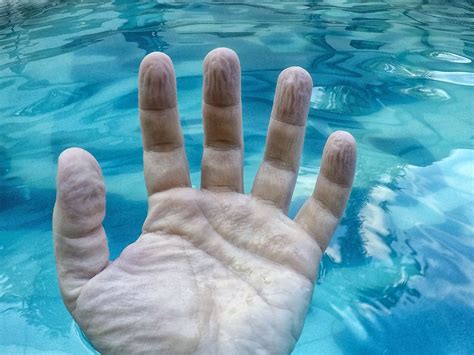 why do fingers get wrinkly after a long bath or swim a biomedical