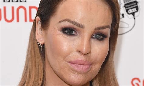 Katie Piper Gives Sad Update On Hospitalisation And Being Away From