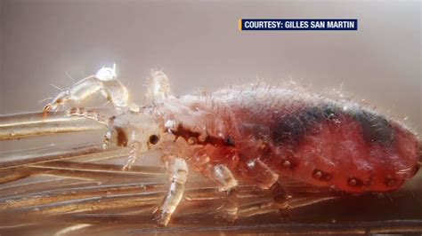 head lice superbug now resistant to treatment in 25 states abc7 new york
