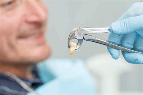 tooth extraction dental health associates