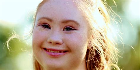 the inspiring teen with down syndrome is now a legit model