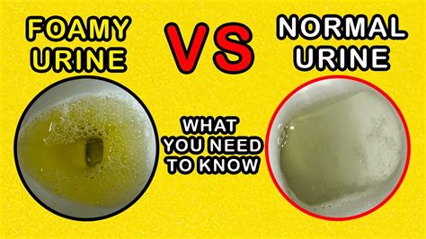 foamy urine  normal urine    difference   youtube