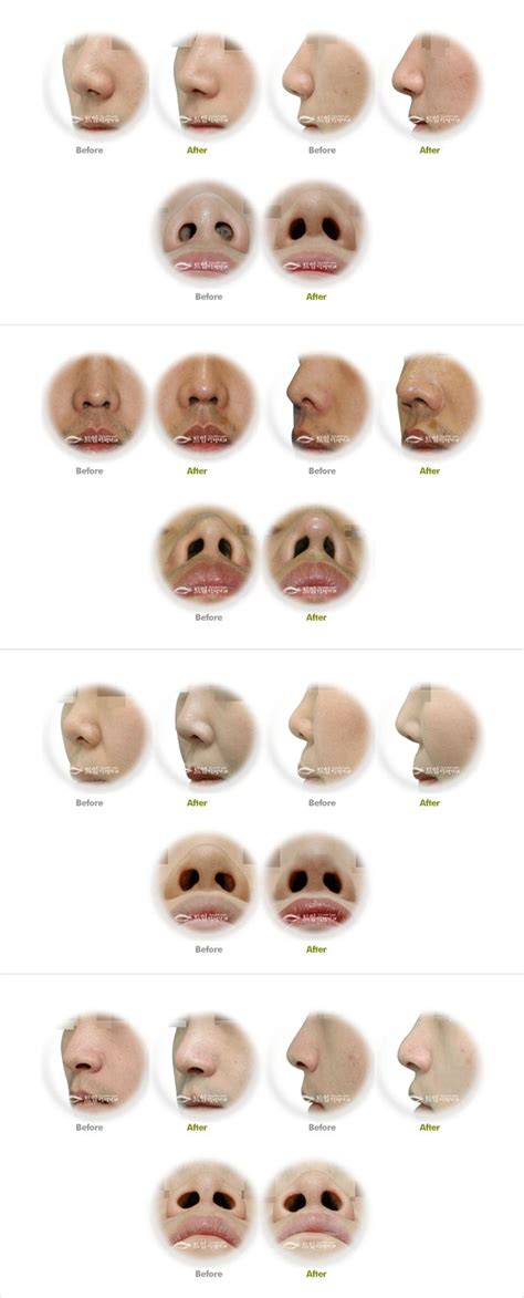 charming   nose shapes   plastic surgeons website