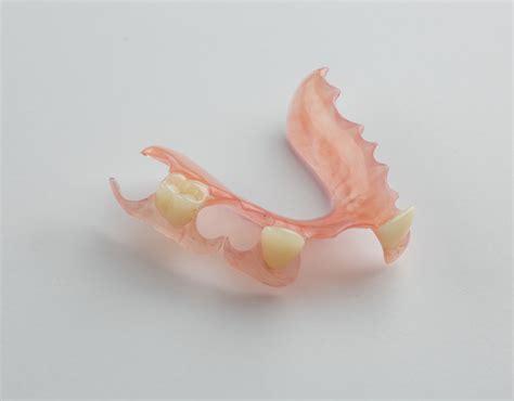 flexible partial dentures   price dental lab direct