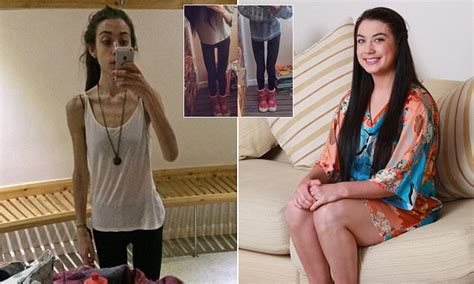 graduate obsessed with getting a thigh gap exercised for three hours