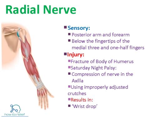 radial nerve  motor sensory common injuries   relief