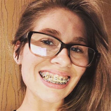 pin on glasses and braces