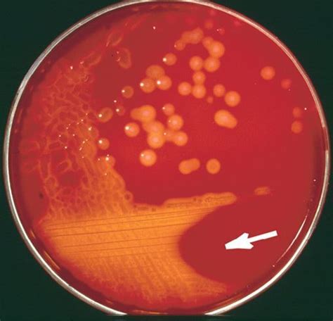 Streptococcus Pyogenes Gas Characteristics Virulence