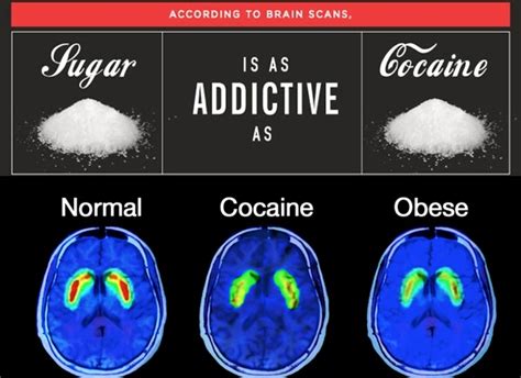 What Happens To Your Brain When You Stop Eating Sugar