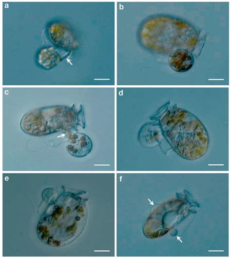 dinophysis acuminata light micrographs   cells feeding