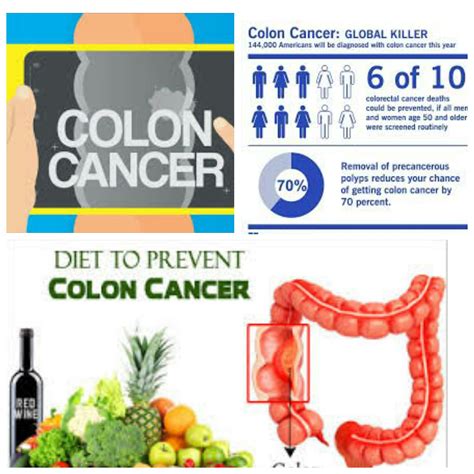 health with diet and sexual health diet to prevent colon