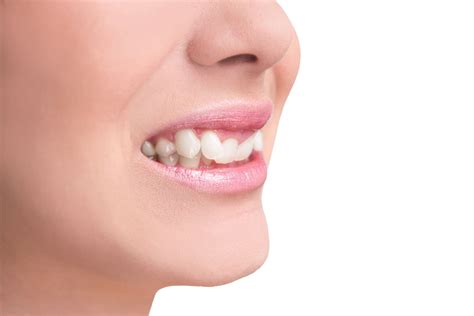 jutted tooth treatment options warsaw  cosmetic dentistry orthodontics