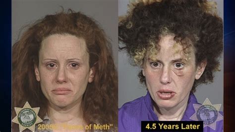 faces of meth addiction
