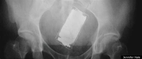 New Book Looks At X Rays Of Objects Stuck In Patients