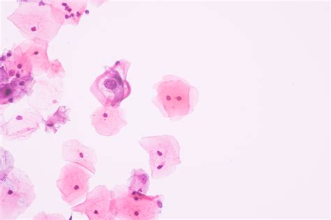 Common Causes Of Abnormal Pap Smear And How To Treat It