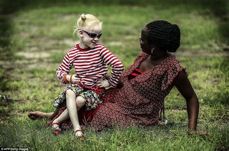 tanzania albino girl among hundreds seeking refuge from