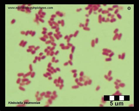 klebsiella pneumoniae microscopy gram stain klebsiella pneumoniae  microscope gram