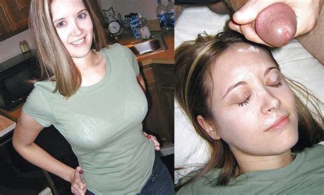 Before And After Facials 48 Pics Xhamster