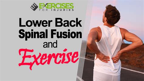 Lower Back Spinal Fusion And Exercise Webinar Exercises For Injuries