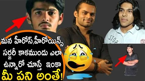 Celebrities Before And After Plastic Surgery Ram Charan