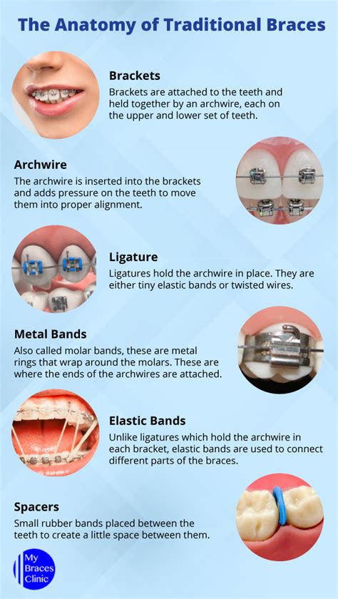 A Complete Guide To Braces Treatment In Singapore