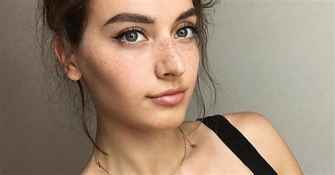 Freckles Imgur