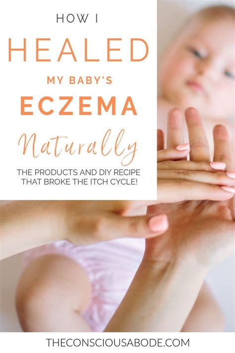 natural eczema solution   works dry skin home remedies