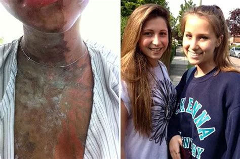 Zanzibar Acid Attack Hero British Tourist Helped Victim As Her Clothes