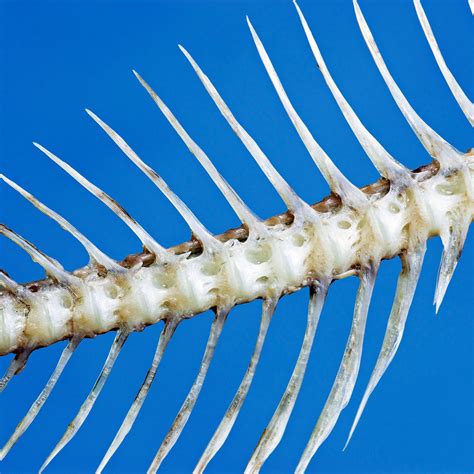 china  special clinics  remove stuck fish bones   throat wsj