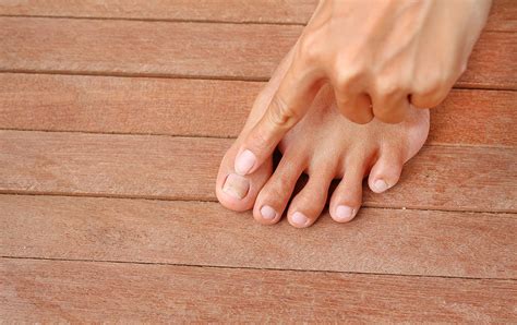 arthritis   big toe northeast foot  ankle