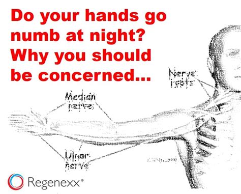 hands numb while sleeping don t ignore this sign regenexx®