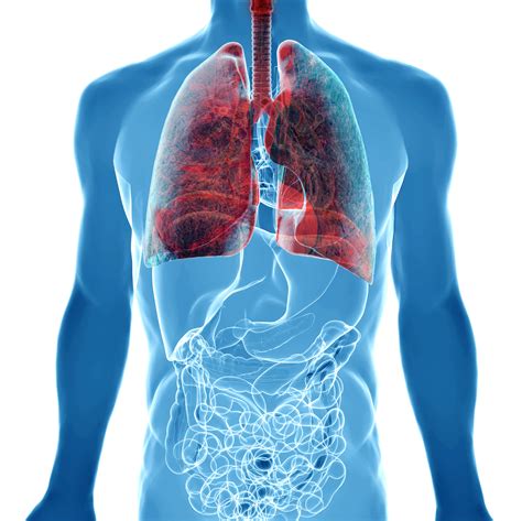 Is Minimally Invasive Surgery For Lung Cancer Best For You