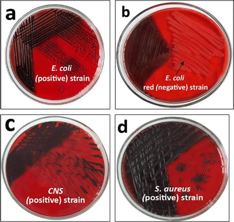 Biofilm Forming Bacteria On Congo Red Agar Plate Clarified
