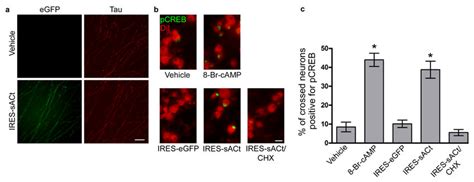axon specific expression  soluble adenylyl cyclase alters signaling  scientific