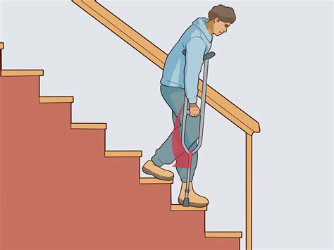 crutches  steps  pictures wikihow