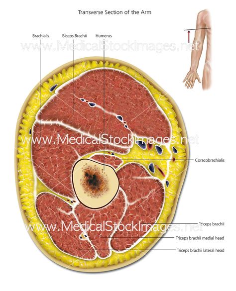 transverse section   arm labelled medical stock images company