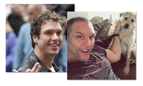 dane cook plastic surgery before and after pics empire bbk