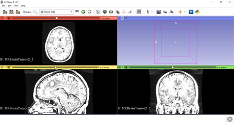 modelling  simulation medical image segmentation   slicer  beginners guide