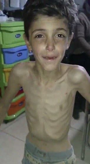 Food Available In Besieged Syrian City Of Madaya Only For The Few Who