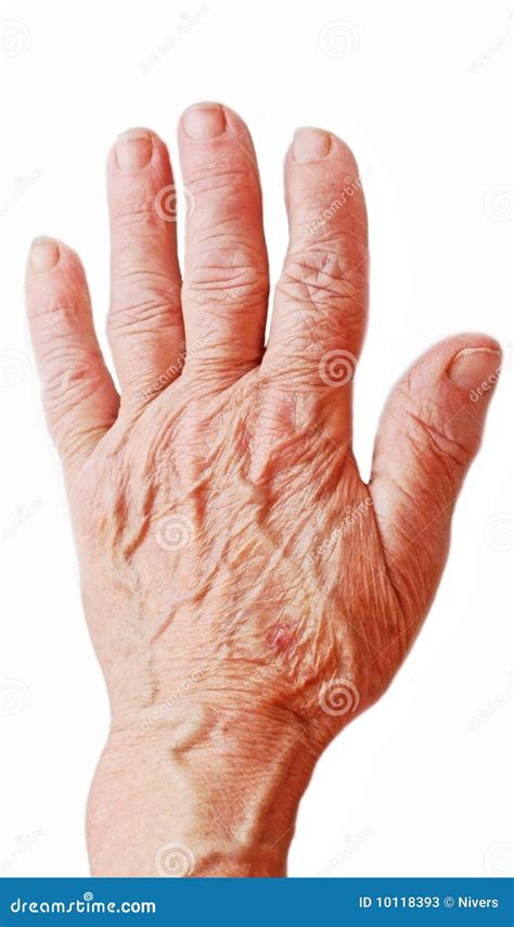 hand stock image image  elder finger terminally