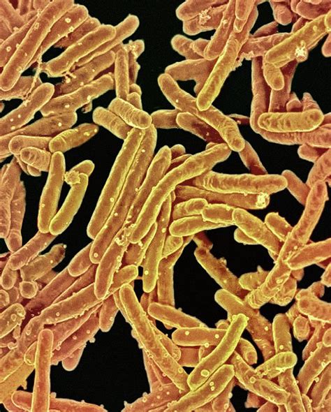 tuberculosis bacteria photograph  ami imagesniaid fine art america