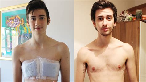 Transgender Man To Woman Transformation