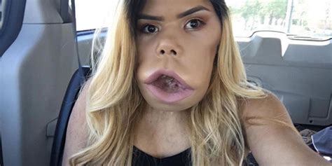 this beauty vlogger with cystic hygroma proves that self acceptance is