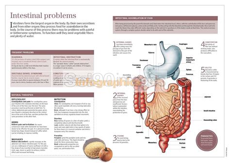 Infografía Problemas Intestinales Infographics90