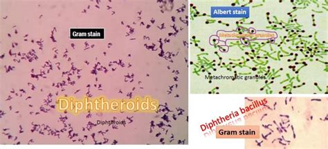 Diphtheria Bacillus Versus Diphtheroids Introduction And Differences In