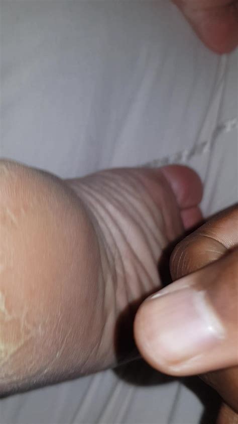mature bbw granny with rough dry wrinkled soles back xhamster