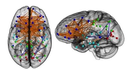 male female brains are wired very differently scans show