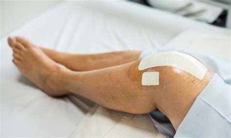 alternate type  surgery  prevent total knee replacement hospital
