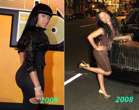 nicki minaj plastic surgeries before and afters ~ trustarr s open thoughts